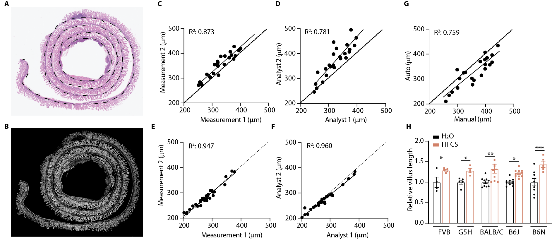 Automating villus image analysis